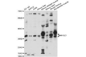 Western blot analysis of extracts of various cell lines, using MYOZ1 antibody (ABIN6290654) at 1:1000 dilution. (Myozenin 1 antibody)