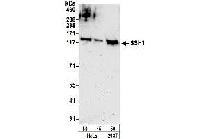 anti-Slingshot Homolog 1 (SSH1) (AA 999-1049) antibody