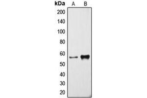 Western blot analysis of Cytochrome P450 3A4 expression in NCIH460 (A), human liver (B) whole cell lysates.