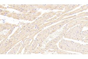 Immunohistochemistry (IHC) image for anti-Leptin Receptor (LEPR) (AA 238-375) antibody (ABIN7430879)