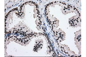 Immunohistochemistry (IHC) image for anti-Glucose-6-Phosphate Dehydrogenase (G6PD) antibody (ABIN2722394)