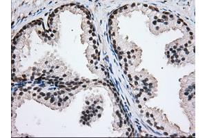 Immunohistochemical staining of paraffin-embedded Human liver tissue using anti-H6PD mouse monoclonal antibody. (Glucose-6-Phosphate Dehydrogenase antibody)