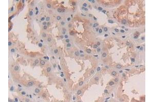 Immunohistochemistry (IHC) image for anti-Legumain (LGMN) (AA 18-433) antibody (ABIN7435007)
