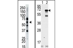 The anti-Epsin2 Pab (ABIN388977 and ABIN2839218) is used in Western blot to detect Epsin2 in mouse brain tissue lysate. (Epsin 2 antibody  (N-Term))