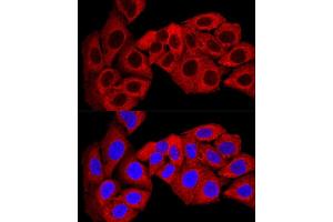 Confocal immunofluorescence analysis of U-2 OS cells using SQSTM1/p62 Polyclonal Antibody (ABIN6128552, ABIN6148419, ABIN6148425 and ABIN6223705) at dilution of 1:200. (SQSTM1 antibody  (AA 1-440))