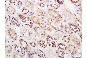 Formalin-fixed and paraffin embedded human kidney labeled with Anti-IGFBP1 Polyclonal Antibody, Unconjugated (ABIN734948) at 1:200 followed by conjugation to the secondary antibody and DAB staining (IGFBPI antibody  (AA 150-250))