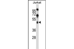 SPN/CD43 Antibody (Center) (ABIN658006 and ABIN2846949) western blot analysis in Jurkat cell line lysates (35 μg/lane). (CD43 antibody  (AA 230-257))
