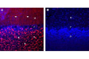 Expression of Synaptotagmin-1 in rat cerebellum. (Synaptotagmin I (SYT1) Peptide)