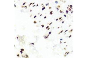 Immunohistochemistry (IHC) image for anti-Proteasome (Prosome, Macropain) 26S Subunit, Non-ATPase, 13 (PSMD13) antibody (ABIN7308240) (PSMD13 antibody)