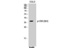 Western Blotting (WB) image for anti-Vitamin D Receptor (VDR) (pSer51) antibody (ABIN3182335) (Vitamin D Receptor antibody  (pSer51))