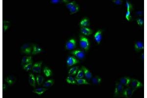 Immunofluorescence staining of Hela cells with ABIN7159461 at 1:100, counter-stained with DAPI. (CNNM4 antibody  (AA 589-691))
