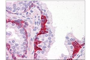 Human Prostate: Formalin-Fixed, Paraffin-Embedded (FFPE) (PIAS3 antibody  (C-Term))