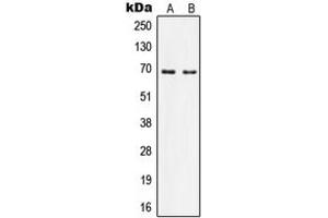 Western blot analysis of Nephrocystin 5 expression in Ramos (A), HeLa (B) whole cell lysates. (IQCB1 antibody  (Center))