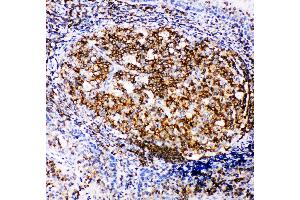 Anti-RIAM antibody, IHC(P) IHC(P): Human Tonsil Tissue (Amyloid beta (A4) Precursor Protein-Binding, Family B, Member 1 Interacting Protein (APBB1IP) (AA 647-666), (C-Term) antibody)