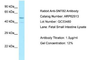 Western Blotting (WB) image for anti-Syntrophin, beta 2 (Dystrophin-Associated Protein A1, 59kDa, Basic Component 2) (SNTB2) (Middle Region) antibody (ABIN2789292)