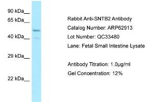 Western Blotting (WB) image for anti-Syntrophin, beta 2 (Dystrophin-Associated Protein A1, 59kDa, Basic Component 2) (SNTB2) (Middle Region) antibody (ABIN971745) (SNTB2 antibody  (Middle Region))