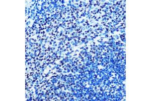 Immunohistochemistry of paraffin-embedded rat spleen using M/M/ML1 Rabbit mAb (ABIN7268354) at dilution of 1:100 (40x lens). (MAD2L1 antibody)