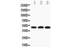 Anti-HYAL3 antibody, Western blotting Lane 1: 22RV Cell Lysate Lane 2: HELA Cell Lysate Lane 3: V20S Cell Lysate (HYAL3 antibody  (C-Term))