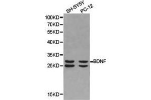Western Blotting (WB) image for anti-Brain-Derived Neurotrophic Factor (BDNF) antibody (ABIN1871274) (BDNF antibody)