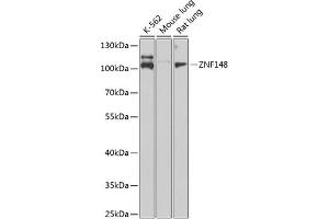 Western blot analysis of extracts of various cell lines, using ZNF148 Antibody (ABIN6130815, ABIN6150463, ABIN6150464 and ABIN6222770) at 1:1000 dilution. (ZNF148 antibody  (AA 690-794))