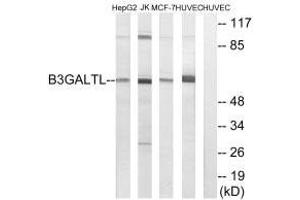 B3GALTL antibody  (C-Term)