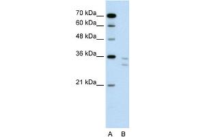 WB Suggested Anti-CD8B Antibody Titration:  0. (CD8B antibody  (N-Term))
