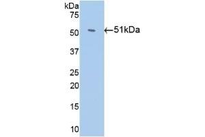 Detection of Recombinant Antithrombin, Human using Monoclonal Antibody to Antithrombin (AT) (SERPINC1 antibody)