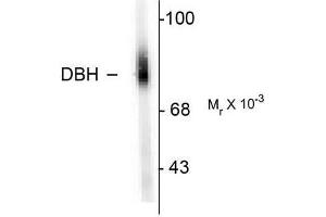 Image no. 1 for anti-Dopamine beta-Hydroxylase (Dopamine beta-Monooxygenase) (DBH) (N-Term) antibody (ABIN372612)