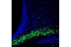 Immunohistochemistry (IHC) image for anti-Calcium/calmodulin-Dependent serine Protein Kinase (MAGUK Family) (CASK) (AA 277-290), (Intracellular) antibody (ABIN7043020)