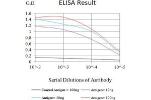 Black line: Control Antigen (100 ng),Purple line: Antigen (10 ng), Blue line: Antigen (50 ng), Red line:Antigen (100 ng) (Progesterone Receptor antibody  (AA 166-411))