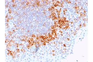 Immunohistochemistry (IHC) image for anti-CD27 Molecule (CD27) antibody (ABIN6941124)