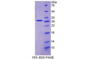 SDS-PAGE (SDS) image for C-Reactive Protein (CRP) (AA 14-224) protein (His tag) (ABIN2124176) (CRP Protein (AA 14-224) (His tag))