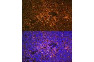 Immunohistochemistry of paraffin-embedded human esophagus using S100 Rabbit pAb (ABIN6129321, ABIN6147336, ABIN6147338 and ABIN6220958) at dilution of 1:350 (40x lens). (S100A12 antibody  (AA 1-92))