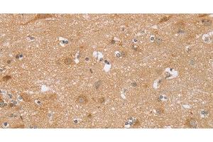 Immunohistochemistry of paraffin-embedded Human brain using TRIM34 Polyclonal Antibody at dilution of 1:30 (TRIM34 antibody)