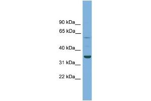 WB Suggested Anti-C3orf67 Antibody Titration: 0. (C3orf67 antibody  (N-Term))