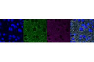 Immunohistochemistry (IHC) image for anti-Synaptophysin (SYP) antibody (ABIN7456148) (Synaptophysin antibody)
