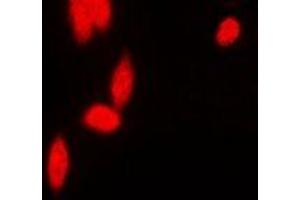 Immunofluorescent analysis of hnRNP E2 staining in MCF7 cells. (PCBP2 antibody)