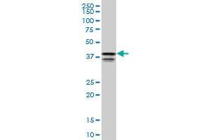 PCBP2 monoclonal antibody (M05), clone 1C7. (PCBP2 antibody  (AA 1-362))