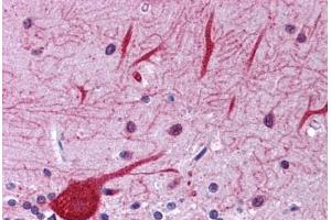 Human Brain, Cerebellum: Formalin-Fixed, Paraffin-Embedded (FFPE) (EIF2AK1 antibody  (AA 108-157))