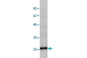 Detection of endogenous CRADD (human) in HEK293T cells by CRADD polyclonal antibody  at 1 : 1000 dilution. (CRADD antibody  (N-Term))