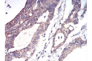 Immunohistochemistry (IHC) image for anti-Aldehyde Dehydrogenase 6 Family, Member A1 (ALDH6A1) (AA 1-195) antibody (ABIN5856297) (ALDH6A1 antibody  (AA 1-195))
