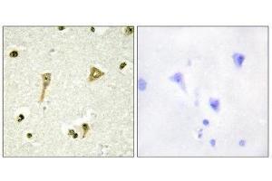 Immunohistochemistry (IHC) image for anti-TSC22 Domain Family, Member 1 (TSC22D1) (N-Term) antibody (ABIN1849646) (TSC22D1 antibody  (N-Term))