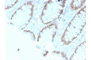 Formalin-fixed, paraffin-embedded human Colon stained with CDX2 Mouse Monoclonal Antibody (rCDX2/1690). (Recombinant CDX2 antibody  (AA 150-249))