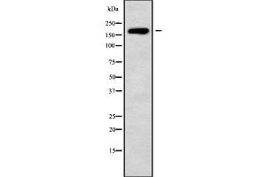 Western blot analysis of HECW1 using K562 whole cell lysates (HECW1 antibody  (Internal Region))