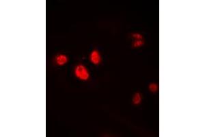 Immunofluorescent analysis of HEN1/2 staining in HEK293T cells. (HEN1/2 (Center) antibody)