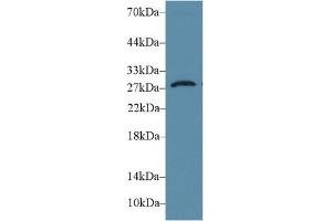 Western Blotting (WB) image for anti-Deiodinase, Iodothyronine, Type III (DIO3) (AA 37-169) antibody (ABIN7436198)