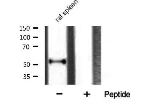 Western Blotting (WB) image for anti-Tumor Protein P53 (TP53) (pSer20) antibody (ABIN6255078)