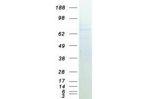 Validation with Western Blot