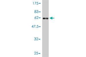 Western Blot detection against Immunogen (51. (MED7 antibody  (AA 1-233))