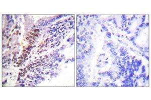 Immunohistochemistry (IHC) image for anti-GR (Internal Region), (pSer226), (pSer234), (pSer246) antibody (ABIN1847260) (GR (Internal Region), (pSer226), (pSer234), (pSer246) antibody)